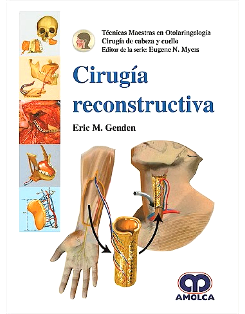 Cirugía Reconstructiva