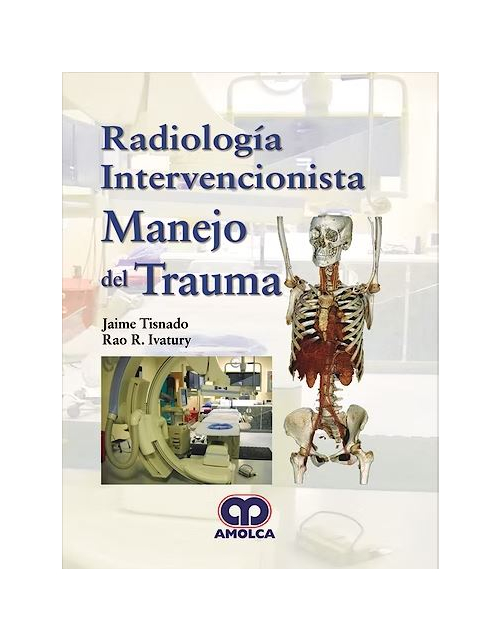Radiología Intervencionista. Manejo del Trauma
