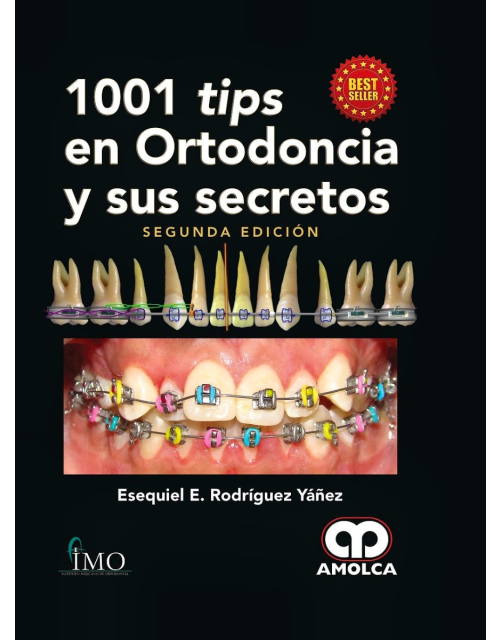 1001 Tips en Ortodoncia y Sus Secretos
