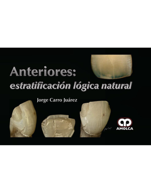 Anteriores: Estratificación Lógica Natural