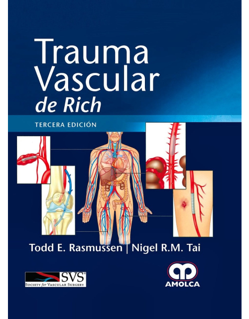 Trauma Vascular de Rich