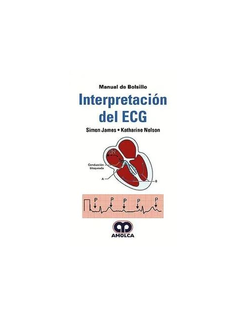 Manual de Bolsillo Interpretación del ECG