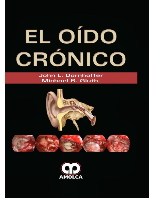 El Oído Crónico