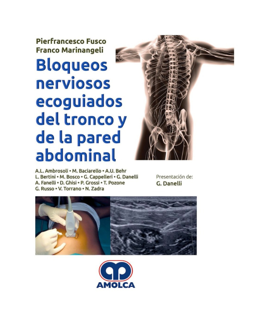 Bloqueos Nerviosos Ecoguiados del Tronco y de la Pared Abdominal