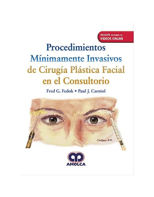 Procedimientos Mínimamente Invasivos de Cirugía Plástica Facial en el Consultorio