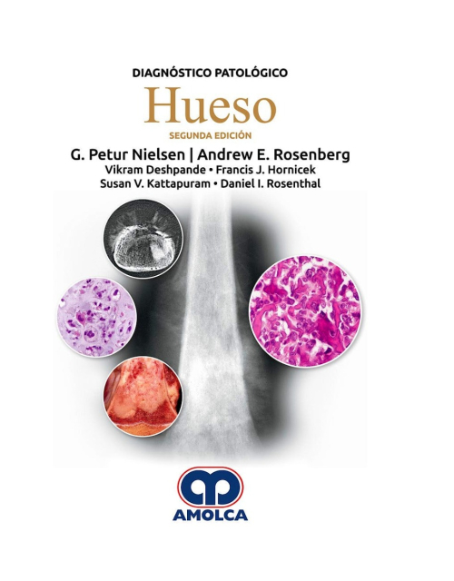 Diagnóstico Patológico. Hueso