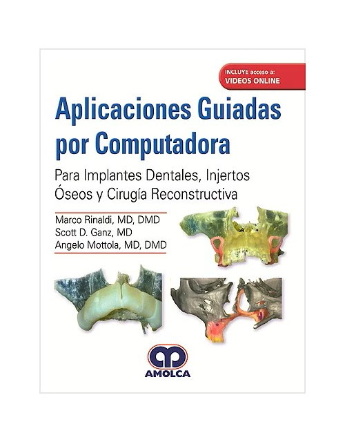 Manejo de Obstáculos Anatómicos en Cirugía Implantar.