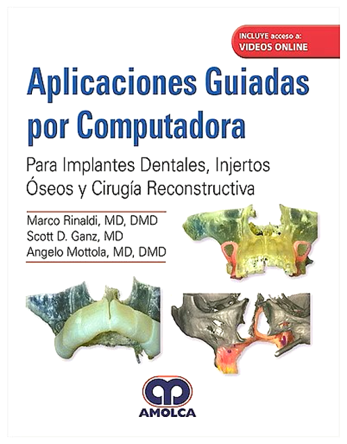 Aplicaciones Guiadas por Computadora.