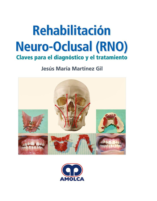 Rehabilitación Neuro-Oclusal (RNO). Claves para el Diagnóstico y el Tratamiento