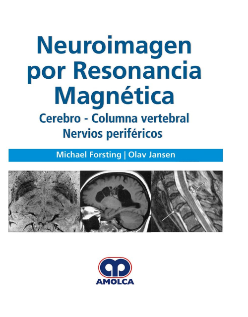 Neuroimagen por Resonancia Magnética. Cerebro, Columna Vertebral, Nervios Periféricos