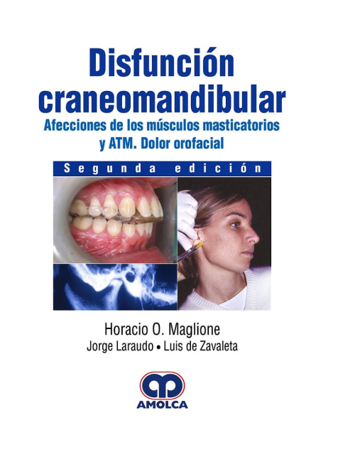 Disfunción Craneomandibular
