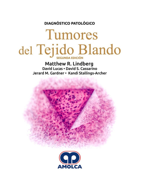 Diagnóstico Patológico. Tumores del Tejido Blando