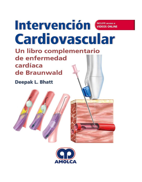 Intervención Cardiovascular