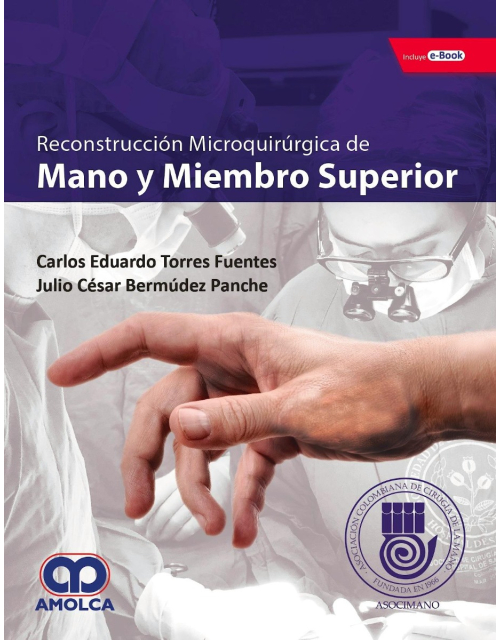 Reconstrucción Microquirúrgica de Mano y Miembro superior
