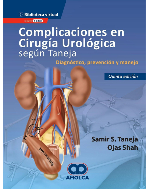 Complicaciones en Cirugía Urológica según Taneja