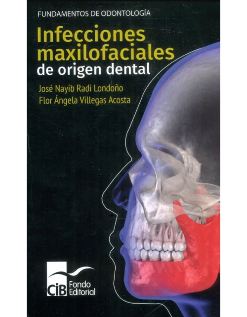 Infecciones Maxilofaciales De Origen Dental, 1A. Ed. (2021)