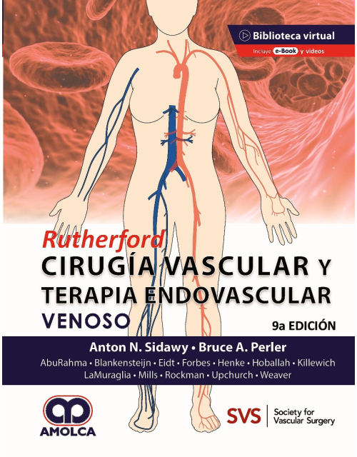 RUTHERFORD Cirugía Vascular y Terapia Endovascular: Venoso