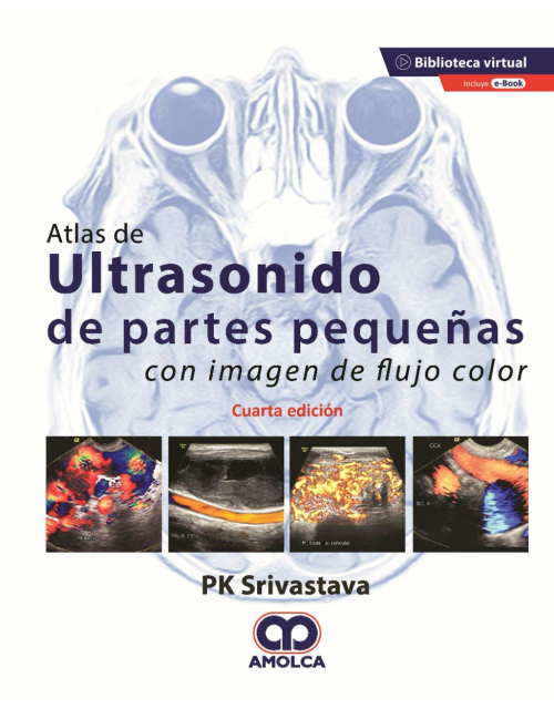 Atlas de Ultrasonido de Pequeñas Partes con Imagen de Flujo Color