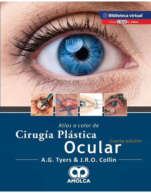 Atlas a Color de Cirugía Plástica Ocular