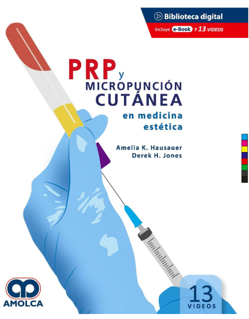 PRP y Micropunción Cutánea en Medicina Estética