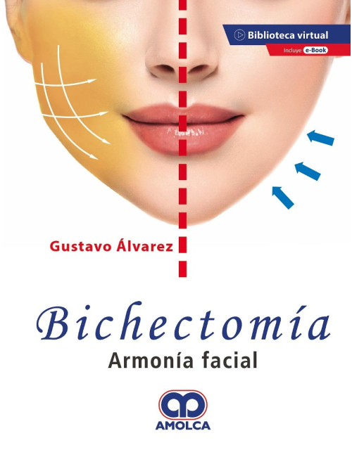 Bichectomía. Armonía Facial