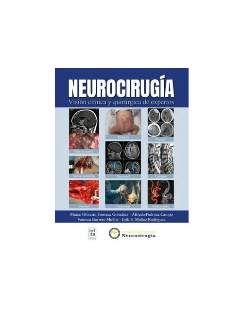Neurocirugía. Visión Clínica y Quirúrgica de Expertos