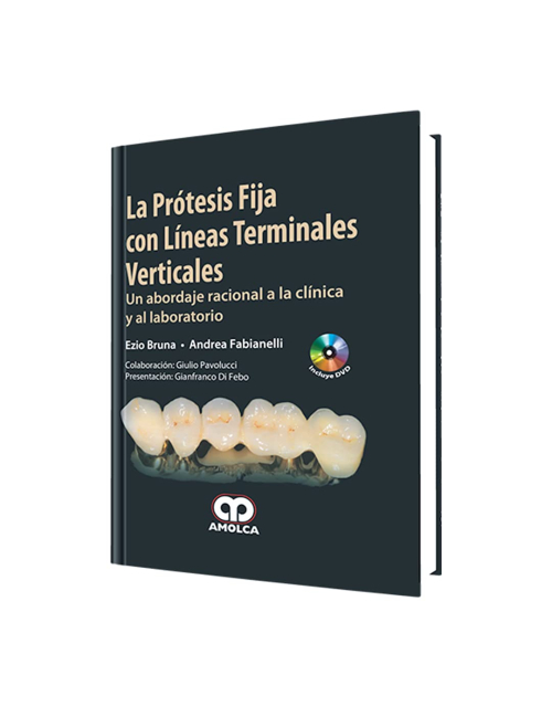 La Prótesis Fija con Líneas Terminales Verticales