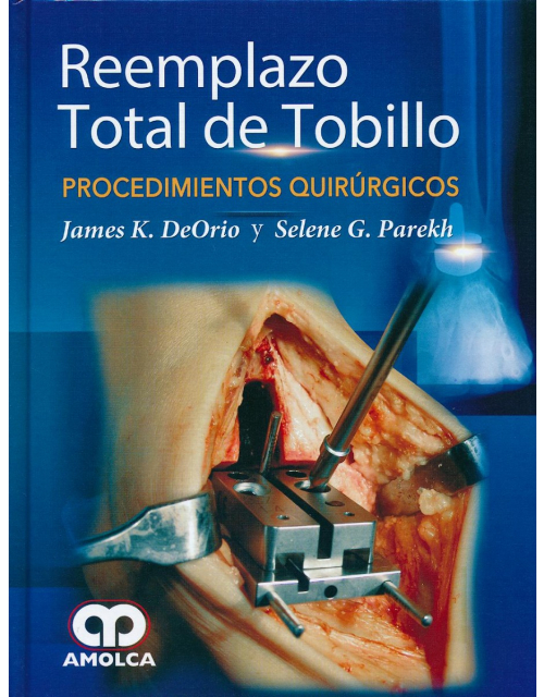 Reemplazo Total de Tobillo. Procedimientos Quirúrgicos