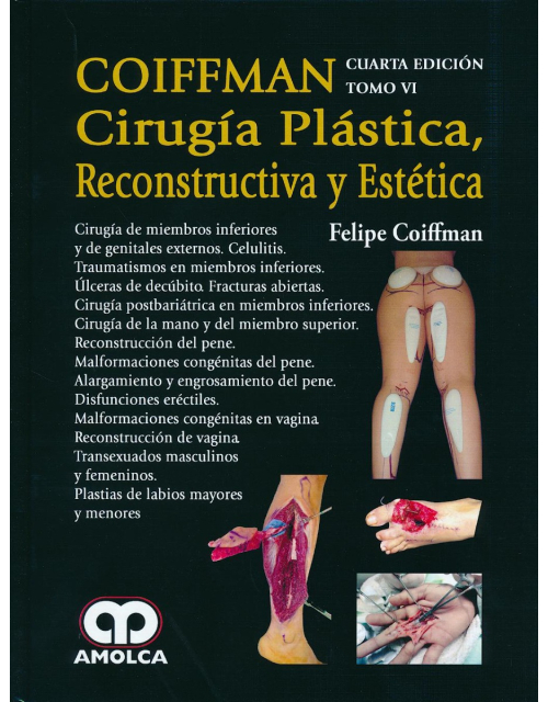 Coiffman Cirugía Plástica, Reconstructiva y Estética, Tomo VI