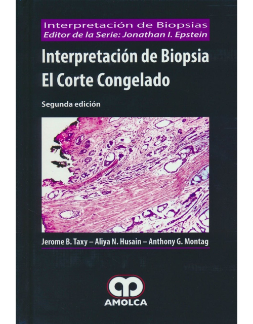 Interpretación de Biopsia. El Corte Congelado (Interpretación de Biopsias)