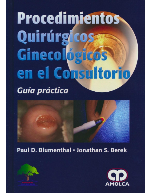 Procedimientos Quirúrgicos Ginecológicos en el Consultorio. Guía Práctica