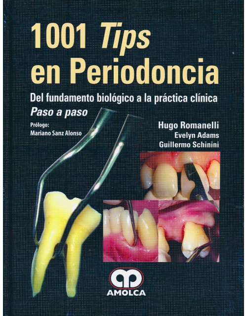1001 Tips en Periodoncia. Del Fundamento Biológico a la Práctica Clínica. Paso a Paso