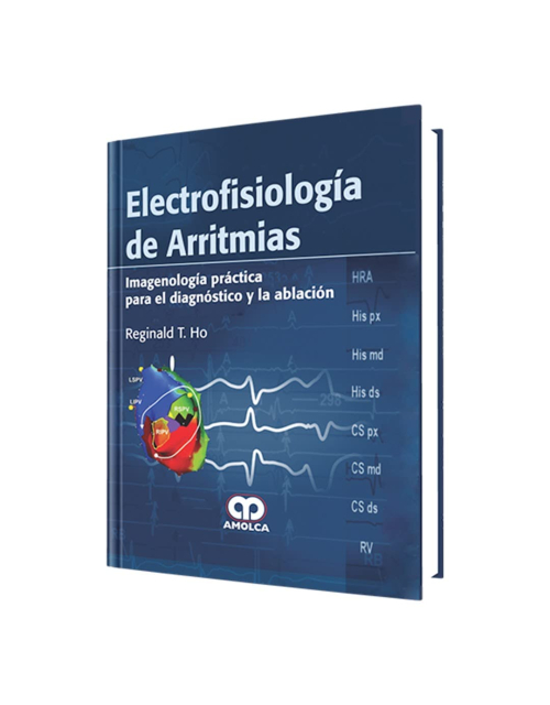 Electrofisiología de Arritmias