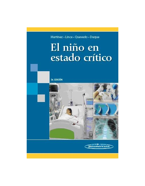 El Niño En Estado Crítico