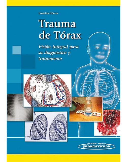 Trauma De Tórax Visión Integral Para Su Diagnóstico Y Tratamiento