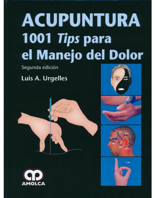 Acupuntura. 1001 Tips para el Manejo del Dolor