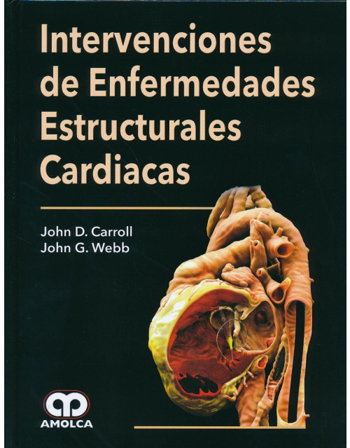 Intervenciones de Enfermedades Estructurales Cardiacas