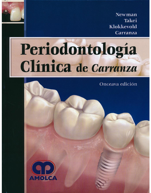Periodontología Clínica de Carranza