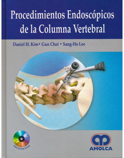 Procedimientos Endoscópicos de la Columna Vertebral