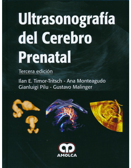Ultrasonografía del Cerebro Prenatal