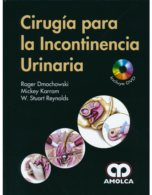 Cirugía para la Incontinencia Urinaria