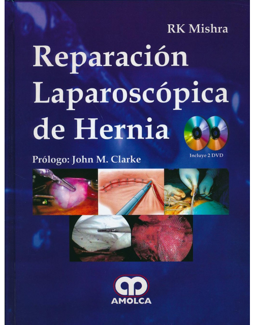 Reparación Laparoscópica de Hernia