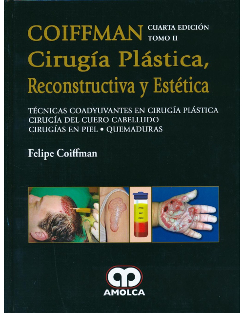 Coiffman Cirugía Plástica, Reconstructiva y Estética, Tomo II