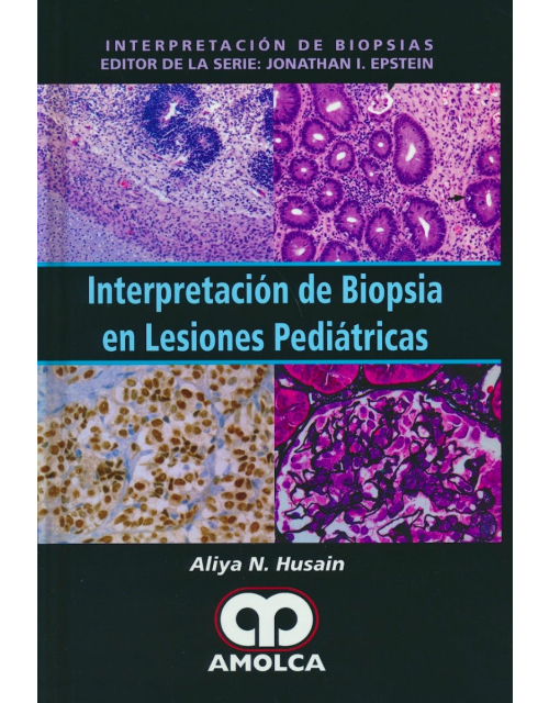 Interpretación de Biopsia en Lesiones Pediátricas
