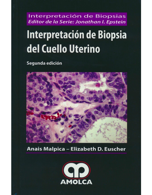 Interpretación de Biopsia del Cuello Uterino 