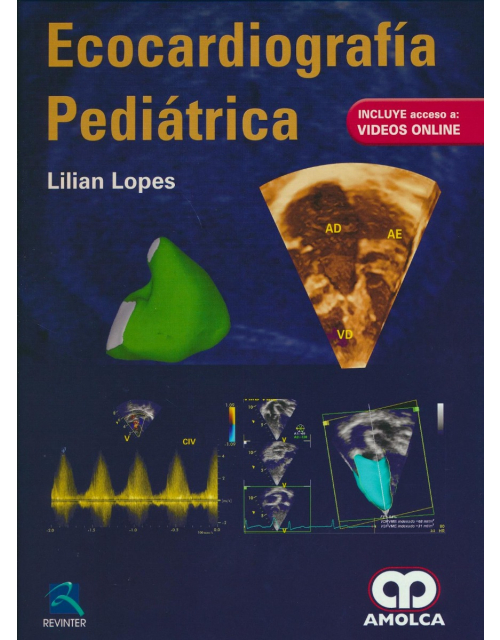Ecocardiografía Pediátrica