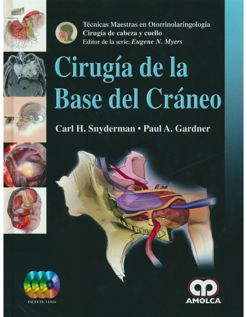 Cirugía de la Base del Cráneo