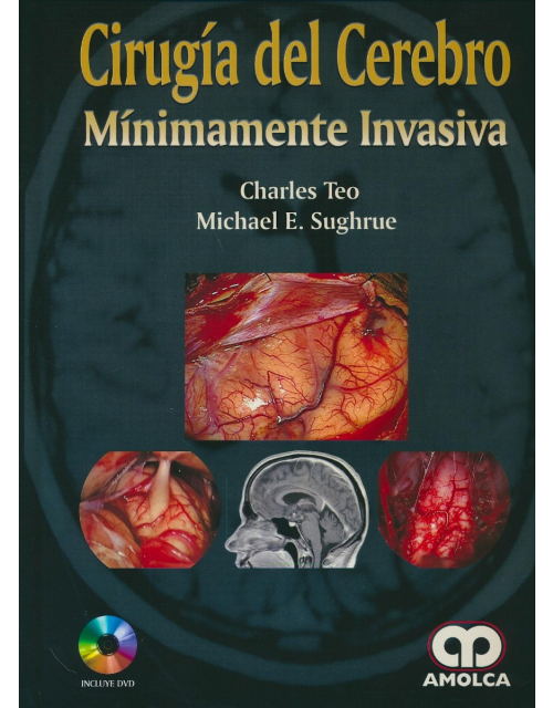 Cirugía del Cerebro Mínimamente Invasiva