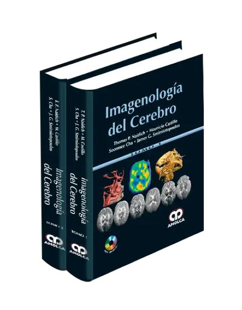 Imagenología del Cerebro, 2 Vols.