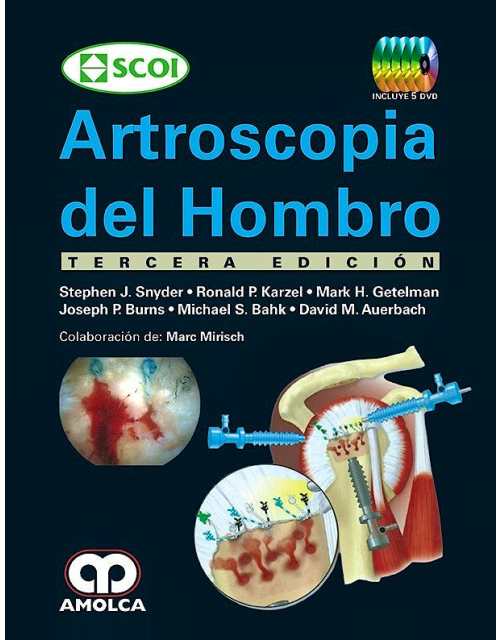 Artroscopia del Hombro